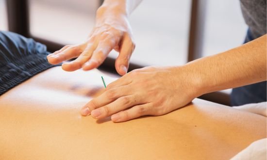 Acupuncture for pain in upper back after sleeping