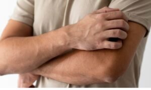 Bulging veins in hands