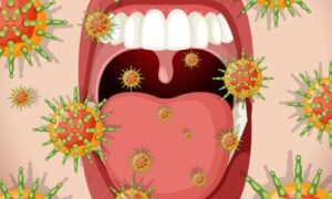 Causes of canker sores vs. oral cancer