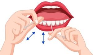 preventive measures for blood blister inside lip