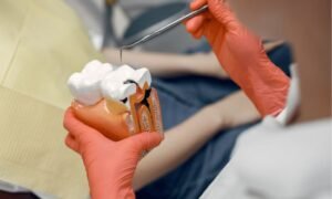 treatment of calcium stains on teeth
